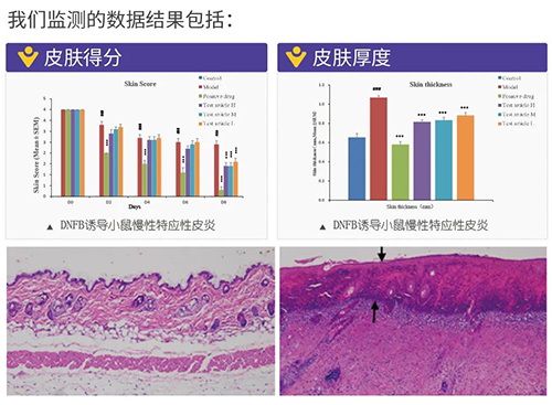 富联娱乐建立的特应性皮炎及湿疹模型监测数据结果