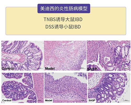 富联娱乐的炎症性肠病模型