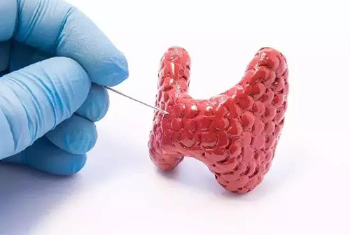 甲状腺疾病，包括甲状腺功能减退和甲状腺功能亢进，自古以来就是反复被医学研究人员研究的疾病