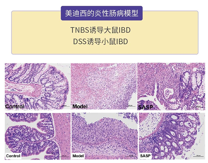 富联娱乐的炎性肠病模型.png